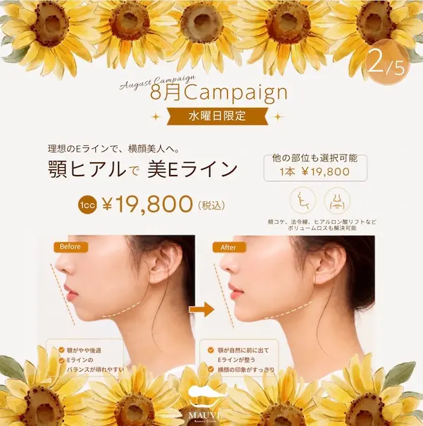 顎ヒアルで美Eライン（2026年8月キャンペーン）
